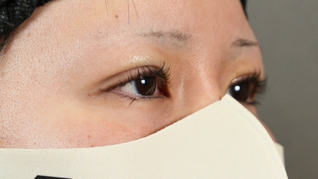 Postoperative Condition Part 1