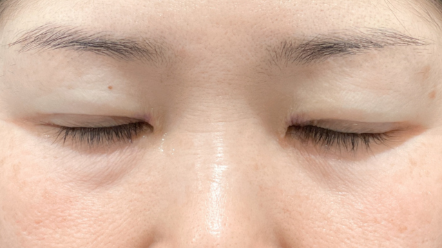 Postoperative Condition Part 1