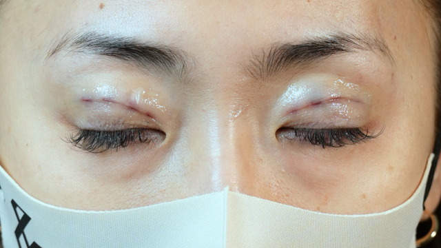 Postoperative Condition Part 1