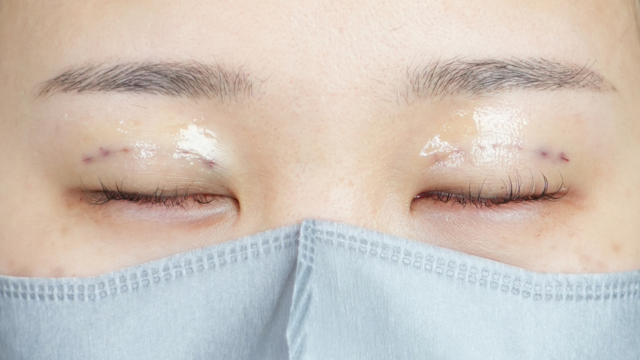 Postoperative Condition Part 1