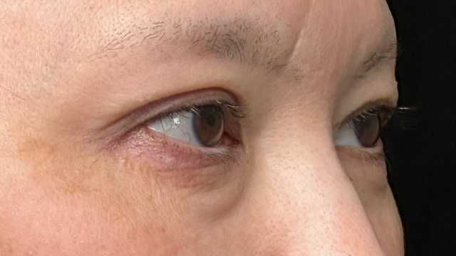 Postoperative Condition Part 1