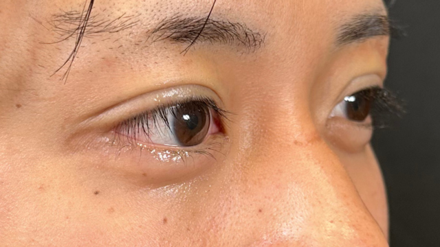 Postoperative Condition Part 1