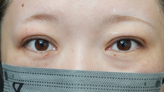 Postoperative Condition Part 1