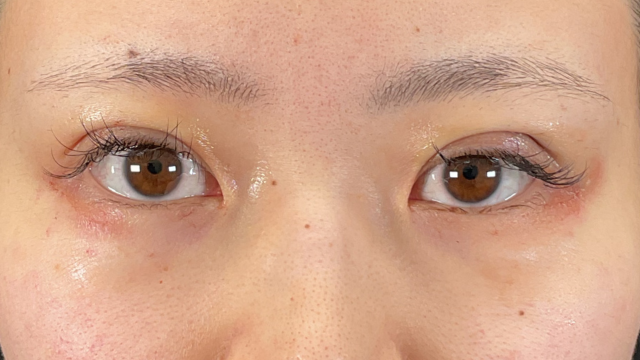 Postoperative Condition Part 1