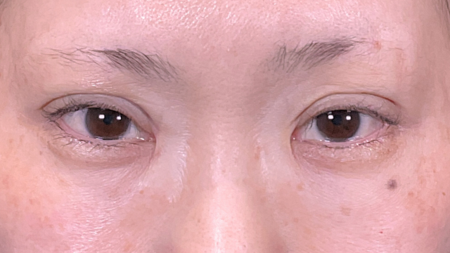 Postoperative Condition Part 1