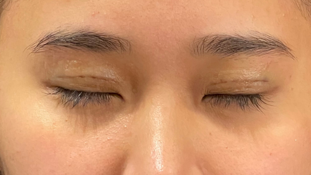 Postoperative Condition Part 1