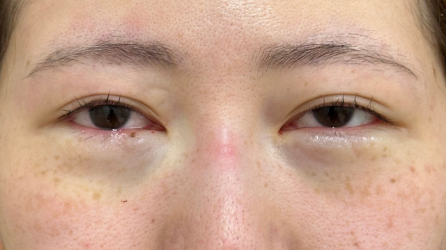 Postoperative Condition Part 1