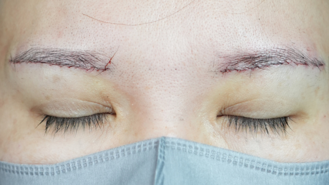 Postoperative Condition Part 1