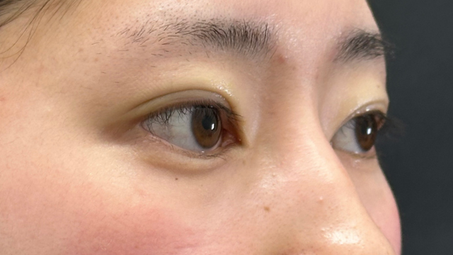 Postoperative Condition Part 1