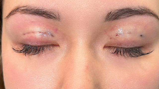 Postoperative Condition Part 1