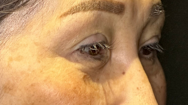 Postoperative Condition Part 1