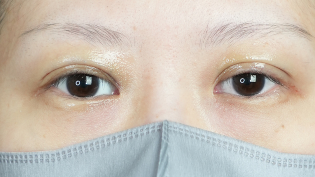 Postoperative Condition Part 1