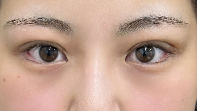 手术前的状态 其一