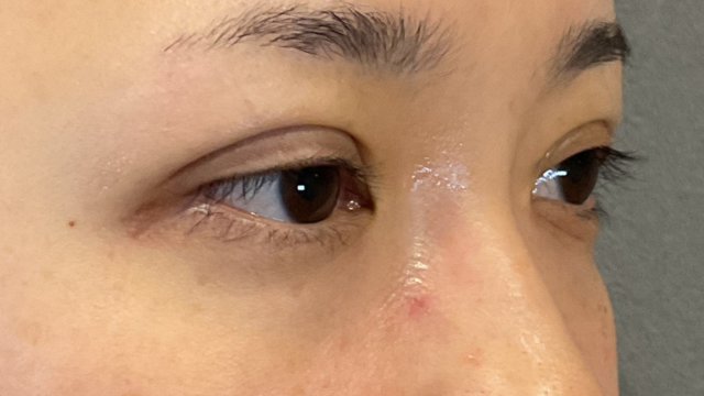 Postoperative Condition Part 1