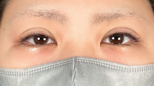 Postoperative Condition Part 1