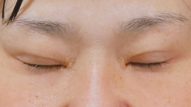 Postoperative Condition Part 1