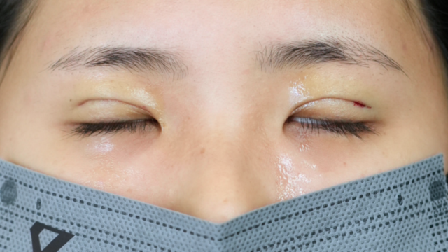 Postoperative Condition Part 1