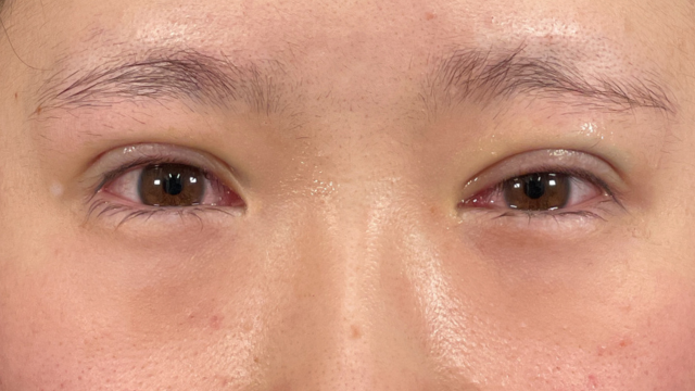 Postoperative Condition Part 1