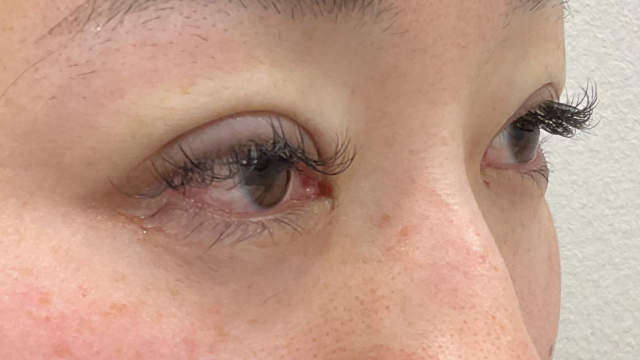 Postoperative Condition Part 1