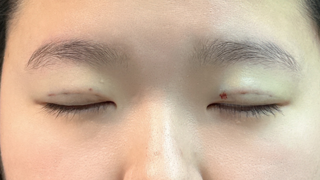 Postoperative Condition Part 1