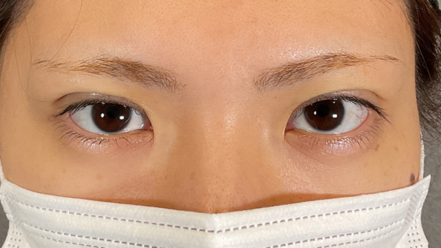 Postoperative Condition Part 1