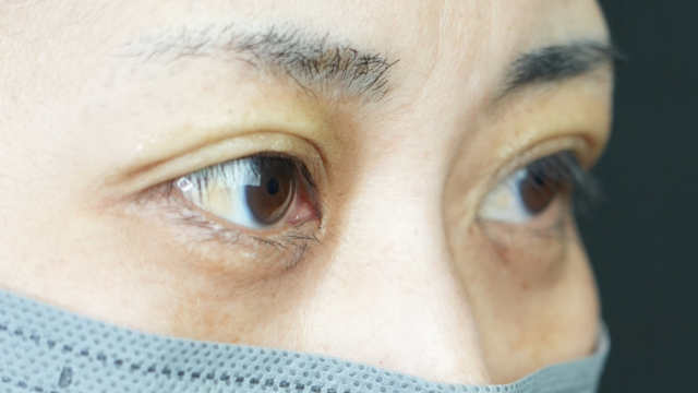 Postoperative Condition Part 1