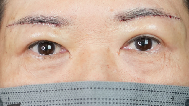 Postoperative Condition Part 1