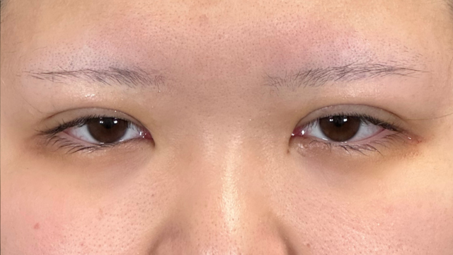 Postoperative Condition Part 1