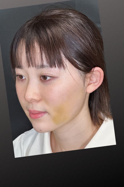 Postoperative Condition Part 1