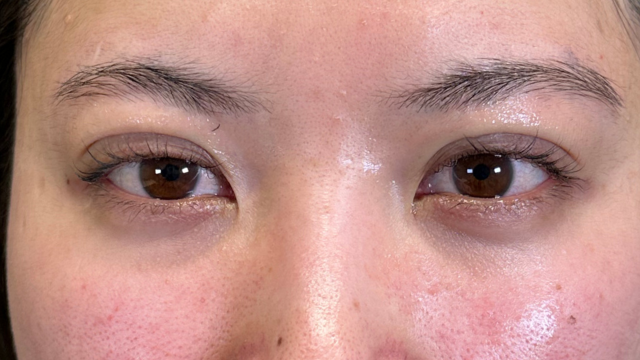 Postoperative Condition Part 1