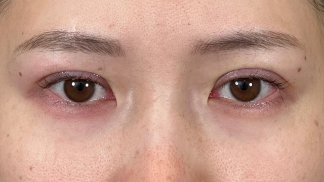 Postoperative Condition Part 1