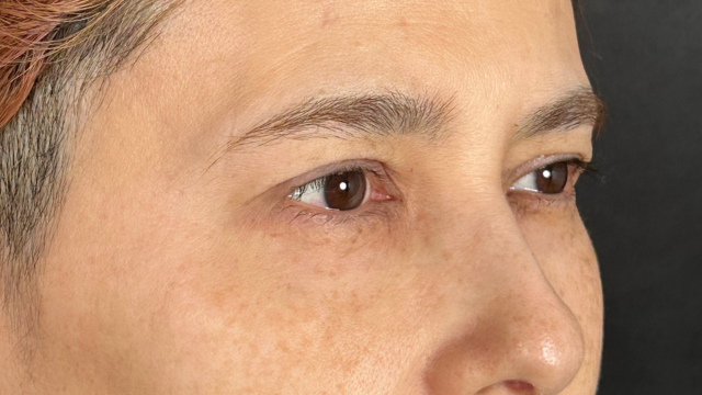 Postoperative Condition Part 1