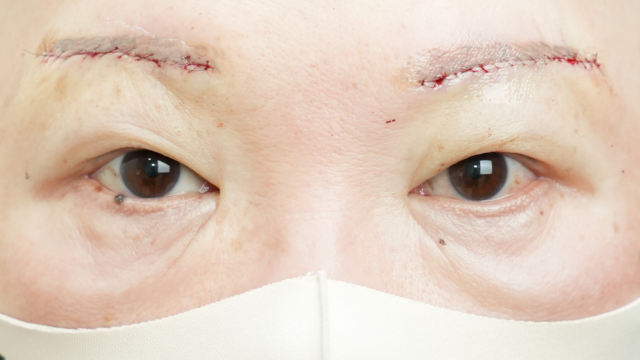 Postoperative Condition Part 1