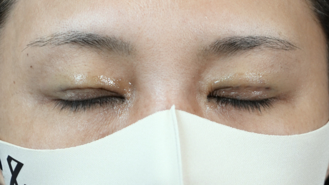 Postoperative Condition Part 1