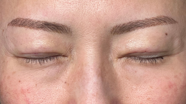 Postoperative Condition Part 1