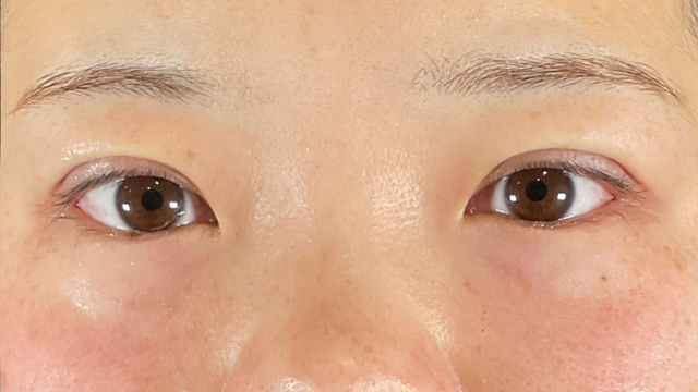 Postoperative Condition Part 1