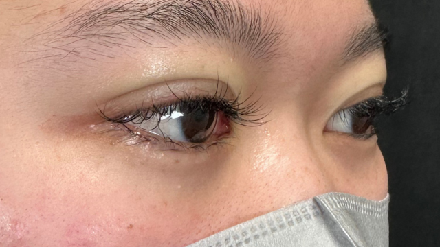 Postoperative Condition Part 1