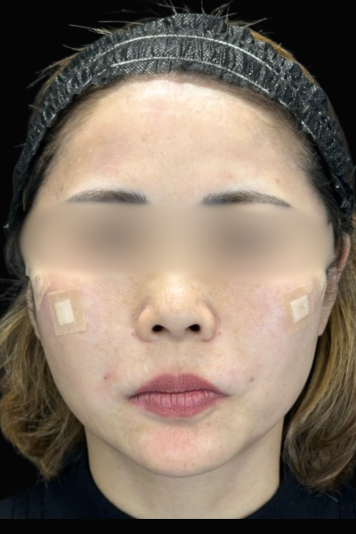 Postoperative Condition Part 1