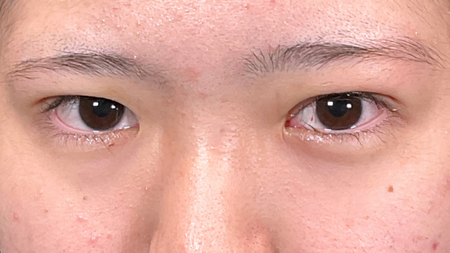 Postoperative Condition Part 1