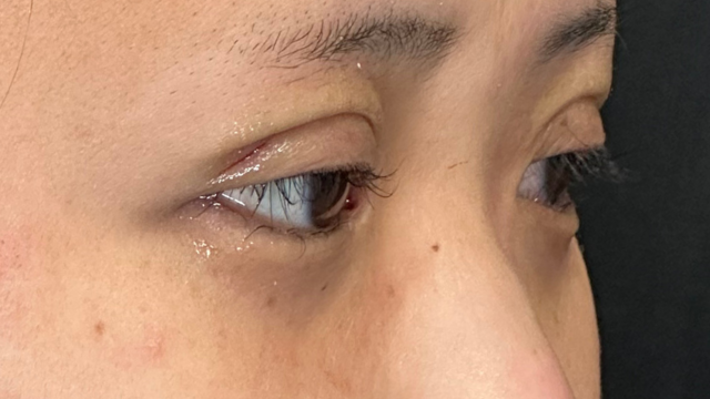 Postoperative Condition Part 1