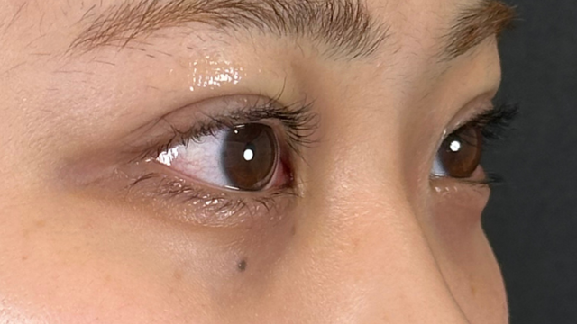 Postoperative Condition Part 1