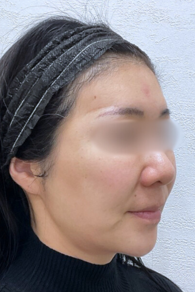 Postoperative Condition Part 1