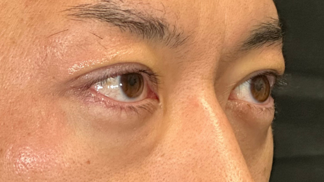 Postoperative Condition Part 1