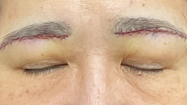 Postoperative Condition Part 1