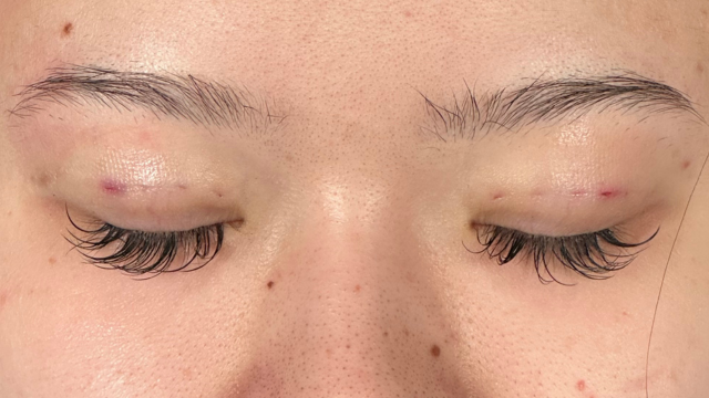 Postoperative Condition Part 1