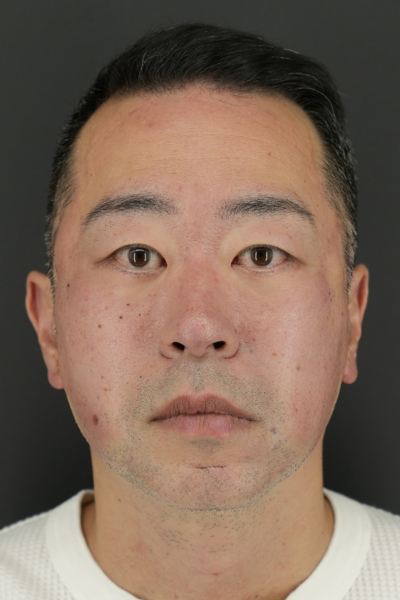 Postoperative Condition Part 1