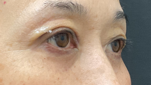 Postoperative Condition Part 1