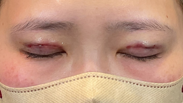 Postoperative Condition Part 1