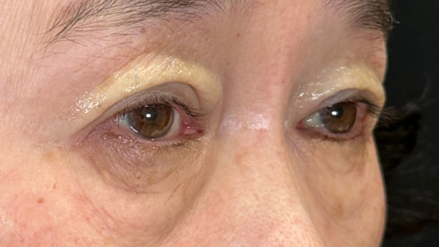 Postoperative Condition Part 1