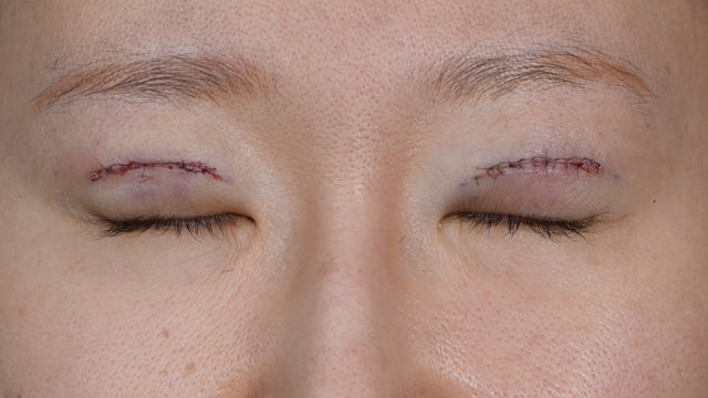 Postoperative Condition Part 1